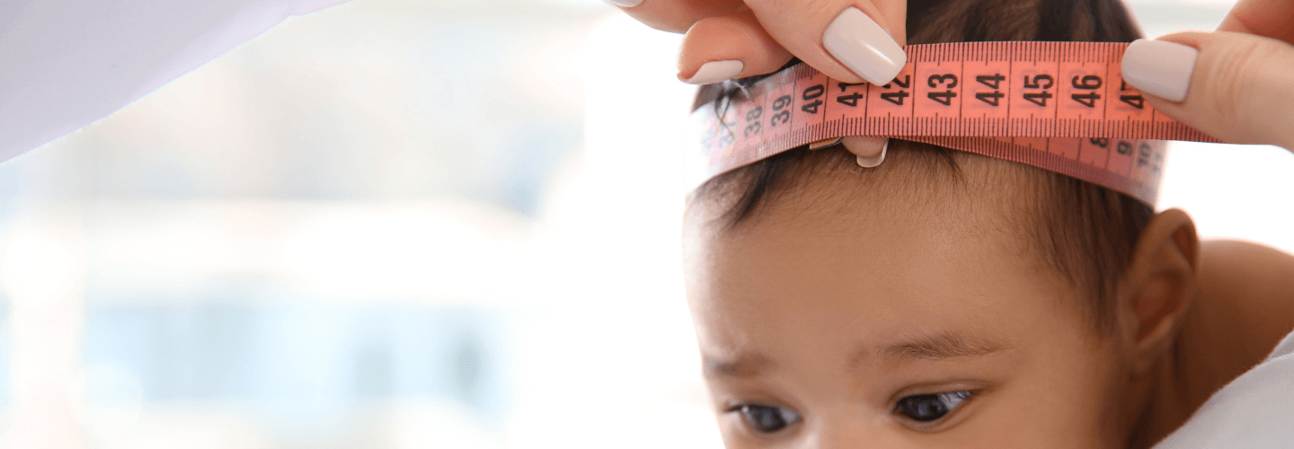 Ukuran Normal Lingkar Kepala Anak Usia 0 10 Tahun
