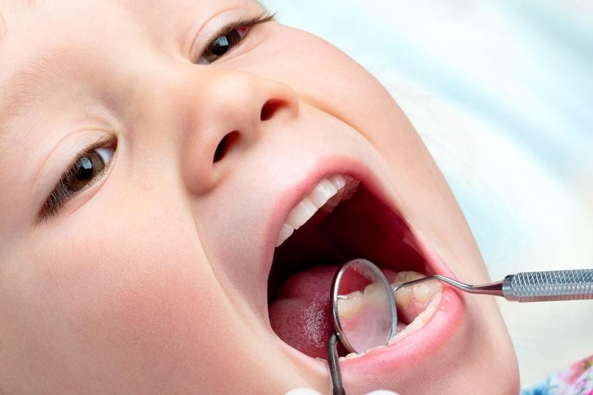 sakit gigi pada anak kecil 7
